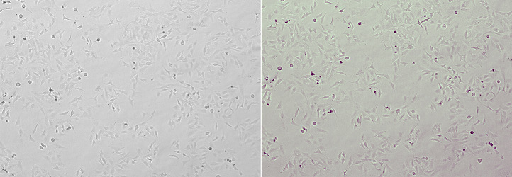 Leica DMi1倒置相差顯微鏡細(xì)胞圖像對(duì)比度增調(diào)整效果對(duì)比.jpg